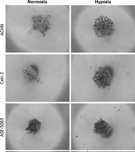 self-renewal test growth in soft agar|Colony, hanging drop, and methylcellulose three dimensional .